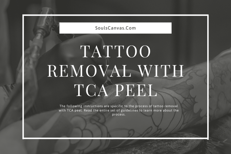 tattoo removal with TCA peel
